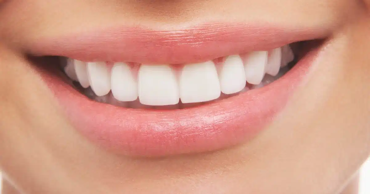 Teeth Care | दातांवरील पिवळेपणा दूर करण्यासाठी करा 'या' पद्धती फॉलो